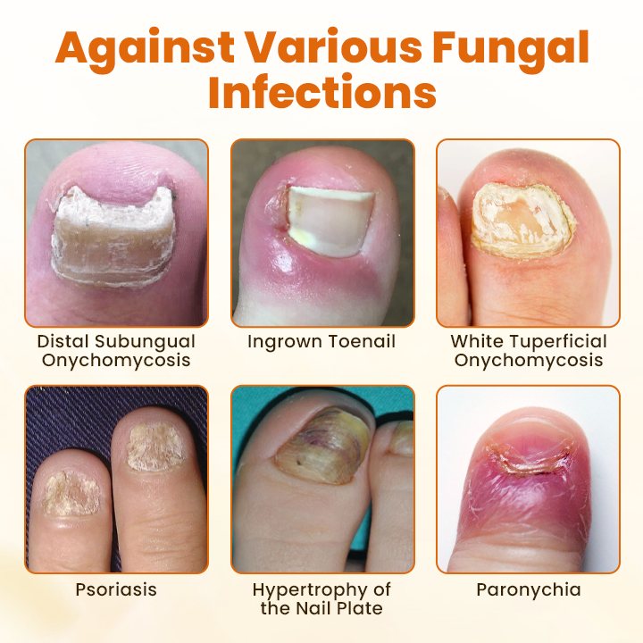 SEAGRIL® FungiBee Advanced Nail Repair Spray