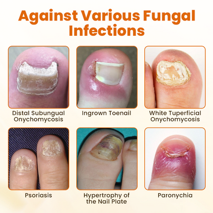 SEAGRIL® FungiBee Advanced Nail Repair Spray