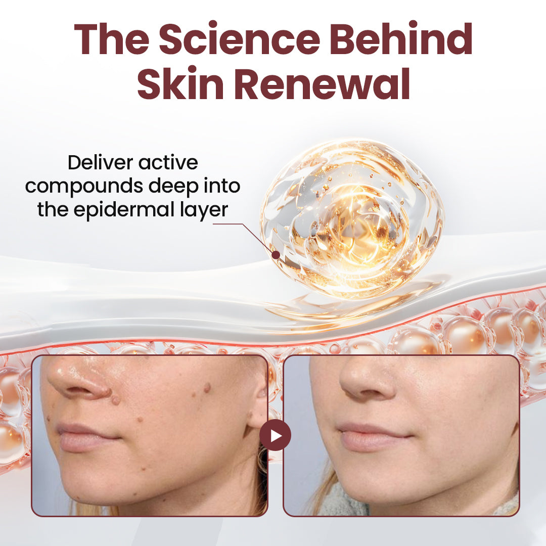 Tiworld®KeraErase Dual-Action Renewal Cream