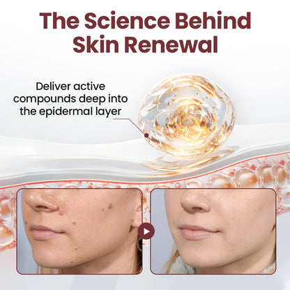 Tiworld®KeraErase Dual-Action Renewal Cream