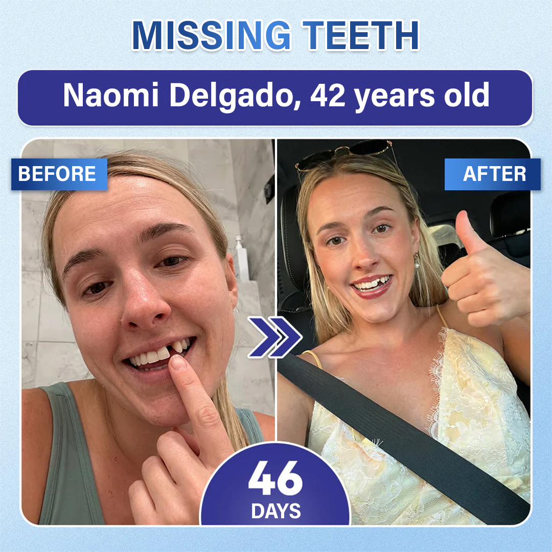 Your Smile🦷SEAGRIL® Tooth & Gum Repair Fast-Dissolving Microneedle Patch✨ (𝟓-𝐢𝐧-𝟏 💎 𝐑𝐞𝐛𝐮𝐢𝐥𝐝 𝐄𝐧𝐚𝐦𝐞𝐥 & 𝐃𝐞𝐧𝐭𝐢𝐧 • 𝐒𝐭𝐫𝐞𝐧𝐠𝐭𝐡𝐞𝐧 𝐆𝐮𝐦𝐬 • 𝐄𝐫𝐚𝐝𝐢𝐜𝐚𝐭𝐞 𝐓𝐚𝐫𝐭𝐚𝐫 & 𝐎𝐝𝐨𝐫 • 𝐖𝐡𝐢𝐭𝐞𝐧𝐢𝐧𝐠 • 𝐒𝐭𝐨𝐩 𝐓𝐨𝐨𝐭𝐡 𝐒𝐞𝐧𝐬𝐢𝐭𝐢𝐯𝐢𝐭𝐲)