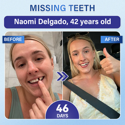 Your Smile🦷SEAGRIL® Tooth & Gum Repair Fast-Dissolving Microneedle Patch✨ (𝟓-𝐢𝐧-𝟏 💎 𝐑𝐞𝐛𝐮𝐢𝐥𝐝 𝐄𝐧𝐚𝐦𝐞𝐥 & 𝐃𝐞𝐧𝐭𝐢𝐧 • 𝐒𝐭𝐫𝐞𝐧𝐠𝐭𝐡𝐞𝐧 𝐆𝐮𝐦𝐬 • 𝐄𝐫𝐚𝐝𝐢𝐜𝐚𝐭𝐞 𝐓𝐚𝐫𝐭𝐚𝐫 & 𝐎𝐝𝐨𝐫 • 𝐖𝐡𝐢𝐭𝐞𝐧𝐢𝐧𝐠 • 𝐒𝐭𝐨𝐩 𝐓𝐨𝐨𝐭𝐡 𝐒𝐞𝐧𝐬𝐢𝐭𝐢𝐯𝐢𝐭𝐲)