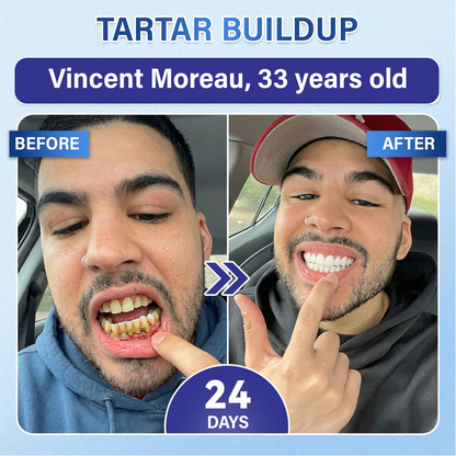 Your Smile🦷SEAGRIL® Tooth & Gum Repair Fast-Dissolving Microneedle Patch✨ (𝟓-𝐢𝐧-𝟏 💎 𝐑𝐞𝐛𝐮𝐢𝐥𝐝 𝐄𝐧𝐚𝐦𝐞𝐥 & 𝐃𝐞𝐧𝐭𝐢𝐧 • 𝐒𝐭𝐫𝐞𝐧𝐠𝐭𝐡𝐞𝐧 𝐆𝐮𝐦𝐬 • 𝐄𝐫𝐚𝐝𝐢𝐜𝐚𝐭𝐞 𝐓𝐚𝐫𝐭𝐚𝐫 & 𝐎𝐝𝐨𝐫 • 𝐖𝐡𝐢𝐭𝐞𝐧𝐢𝐧𝐠 • 𝐒𝐭𝐨𝐩 𝐓𝐨𝐨𝐭𝐡 𝐒𝐞𝐧𝐬𝐢𝐭𝐢𝐯𝐢𝐭𝐲)