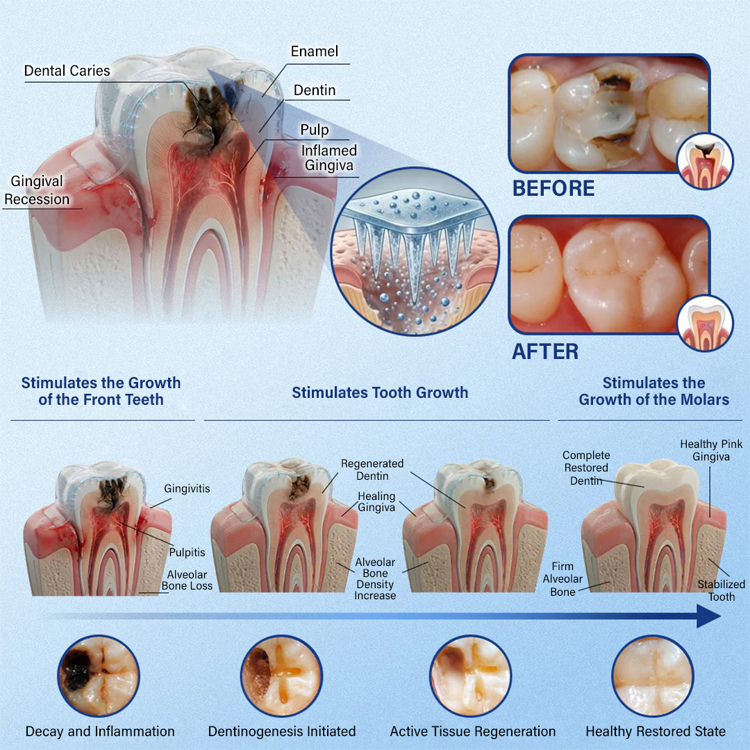 Your Smile🦷SEAGRIL® Tooth & Gum Repair Fast-Dissolving Microneedle Patch✨ (𝟓-𝐢𝐧-𝟏 💎 𝐑𝐞𝐛𝐮𝐢𝐥𝐝 𝐄𝐧𝐚𝐦𝐞𝐥 & 𝐃𝐞𝐧𝐭𝐢𝐧 • 𝐒𝐭𝐫𝐞𝐧𝐠𝐭𝐡𝐞𝐧 𝐆𝐮𝐦𝐬 • 𝐄𝐫𝐚𝐝𝐢𝐜𝐚𝐭𝐞 𝐓𝐚𝐫𝐭𝐚𝐫 & 𝐎𝐝𝐨𝐫 • 𝐖𝐡𝐢𝐭𝐞𝐧𝐢𝐧𝐠 • 𝐒𝐭𝐨𝐩 𝐓𝐨𝐨𝐭𝐡 𝐒𝐞𝐧𝐬𝐢𝐭𝐢𝐯𝐢𝐭𝐲)