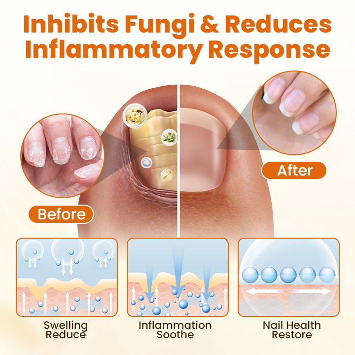 SEAGRIL® FungiBee Advanced Nail Repair Spray