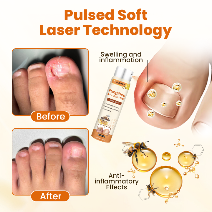 SEAGRIL® FungiBee Advanced Nail Repair Spray