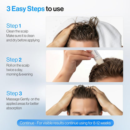 👑2026 Eaily Hot Sale Ends Today: 70% OFF!Tiworld™-beard growth serum