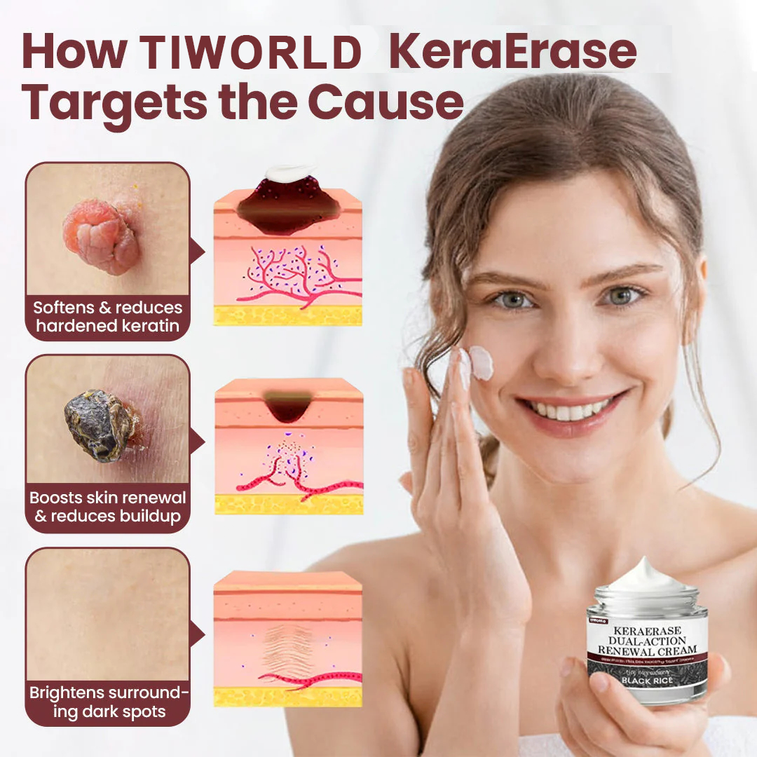 Tiworld®KeraErase Dual-Action Renewal Cream