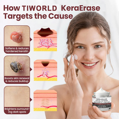Tiworld®KeraErase Dual-Action Renewal Cream