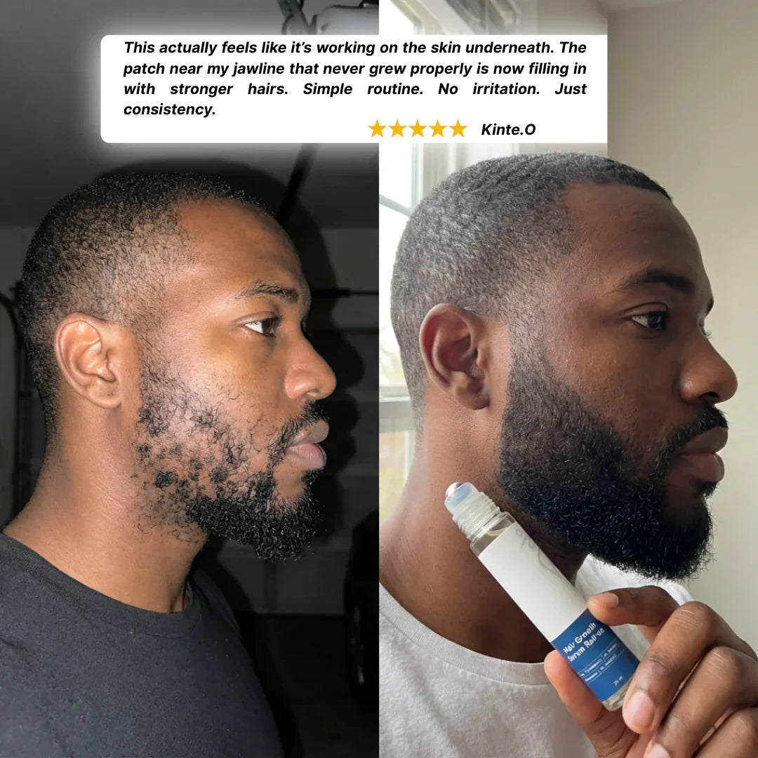 👑2026 Eaily Hot Sale Ends Today: 70% OFF!Tiworld™-beard growth serum