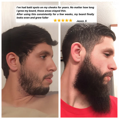 👑2026 Eaily Hot Sale Ends Today: 70% OFF!Tiworld™-beard growth serum